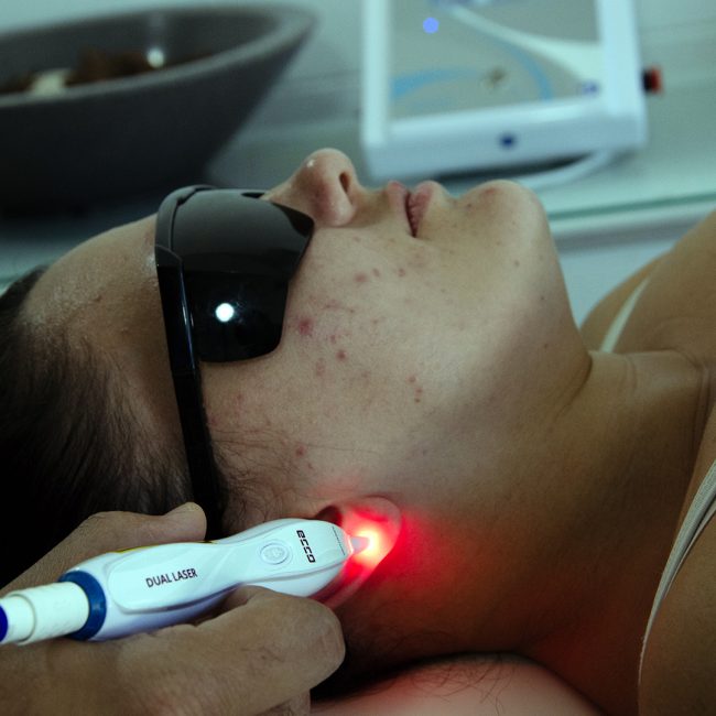 Ecco_Acupunture_Aplicacao_DFA9009_Web.jpg
