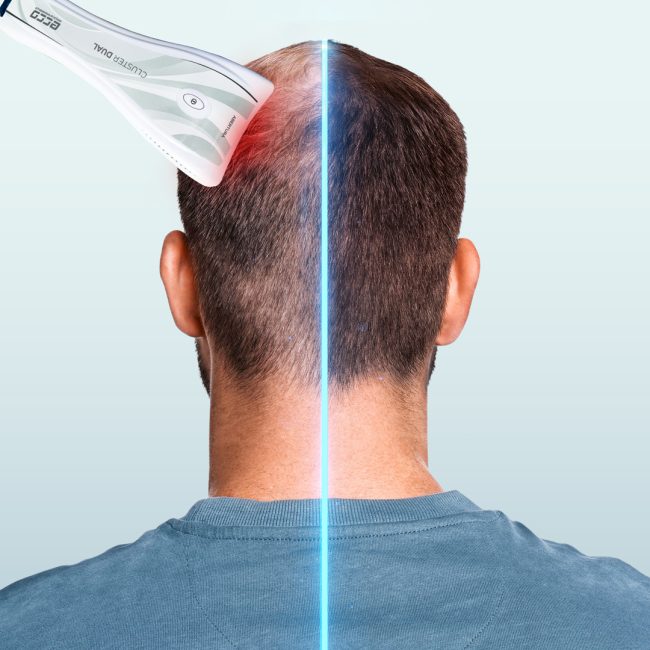 Ecco_Hair_Aplicacao_2074480813_Web.jpg
